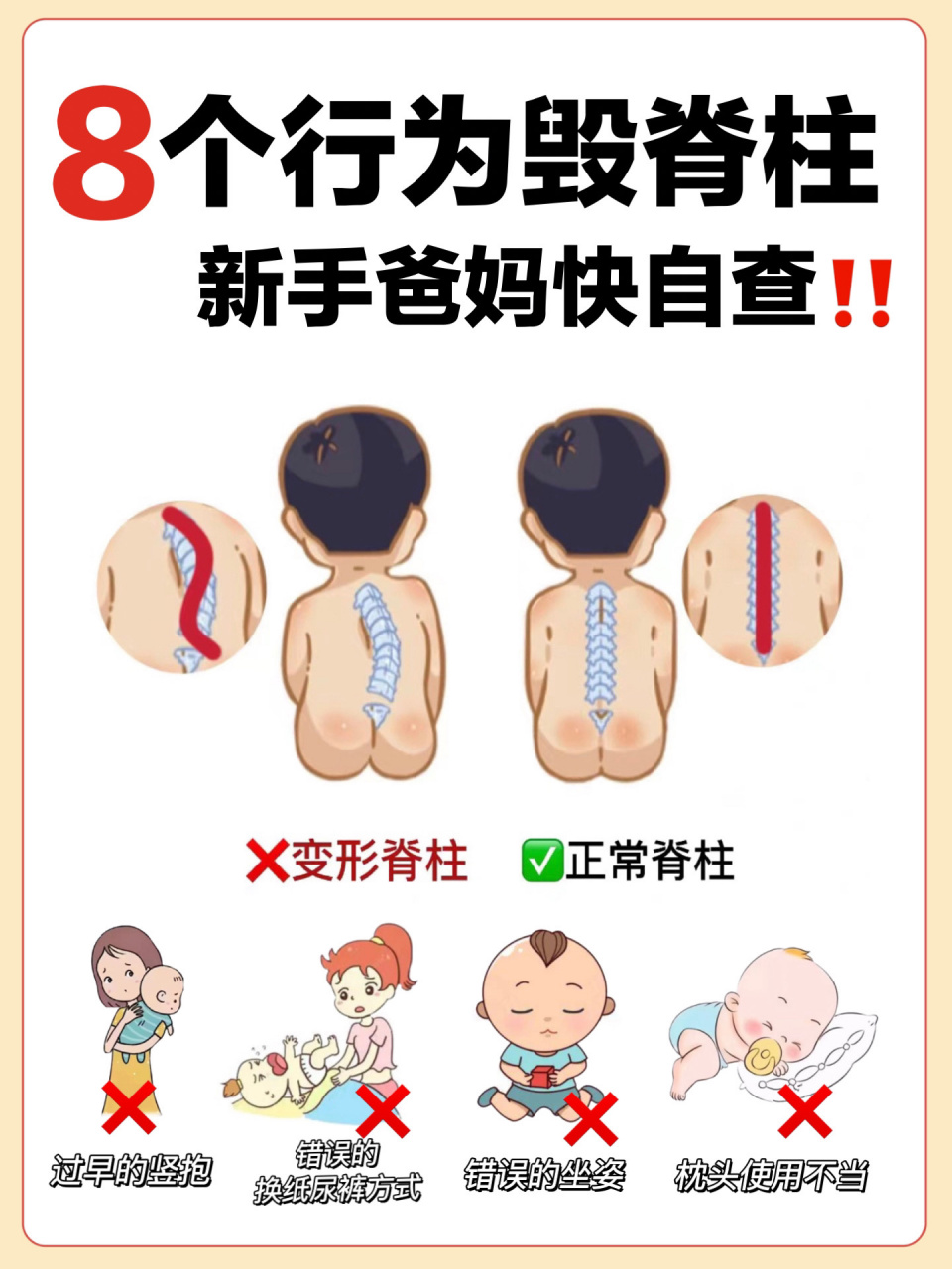 宝宝脊柱侧弯危害大988个行为毁害宝宝脊柱 新手爸妈注意6015