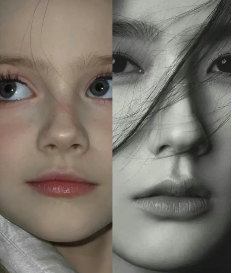 人造盒型鼻不是谁想就做,不仅要求原生的鼻头软骨发育好,鼻头皮肤也要