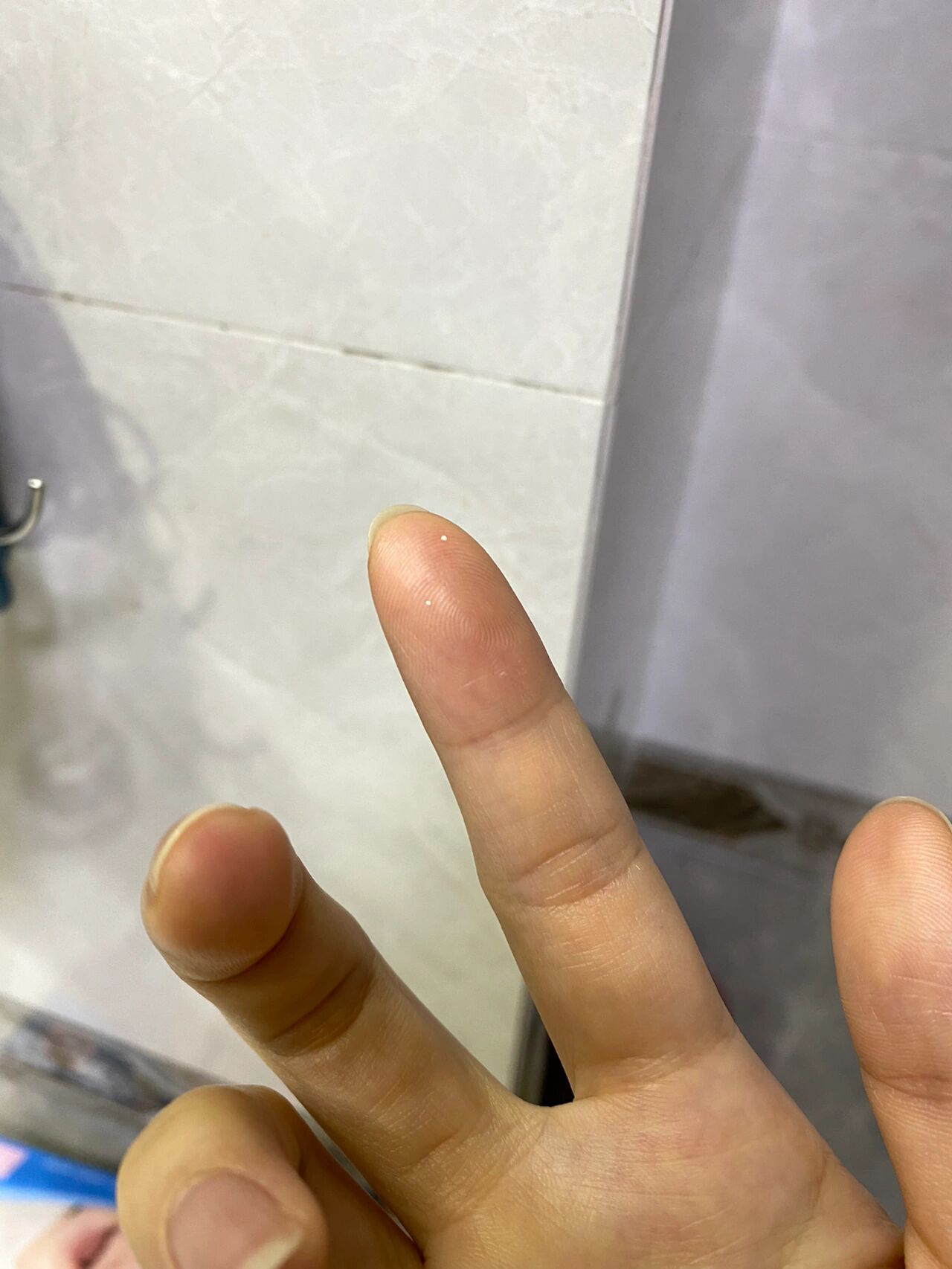 同一个乳孔4颗小白点… 三天两头堵奶,这次是左侧堵超严重,我这次直接