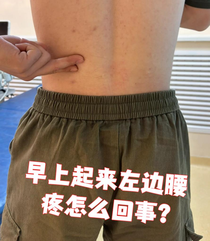 早上起来左边腰疼可能和睡姿不好,腰肌劳损或者筋膜炎有关