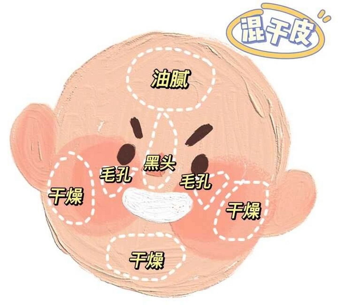 如何区分混油皮和混干皮 1,什么是混油皮,混干皮 混油皮和混干皮统称