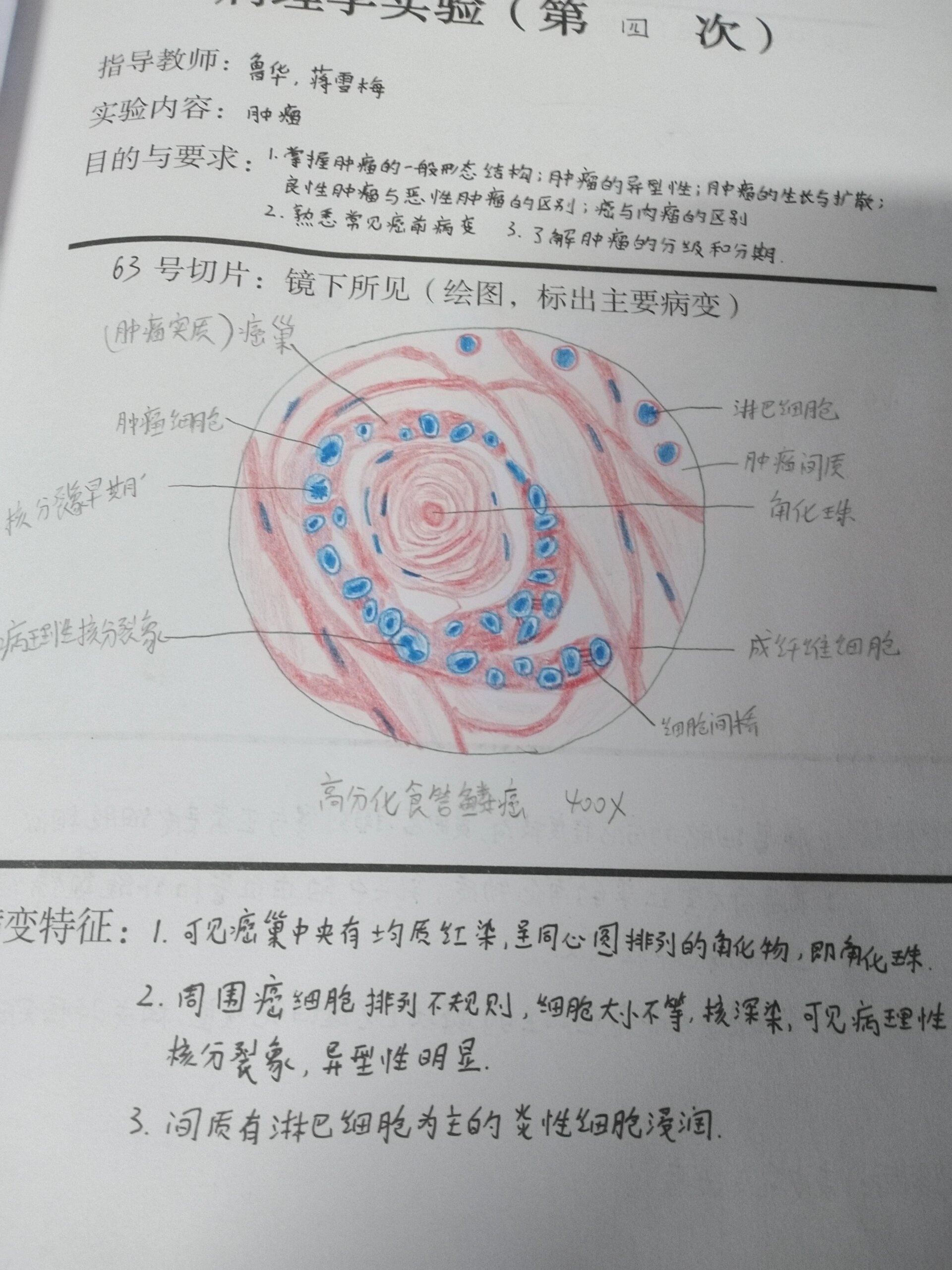 病理学实验报告:肿瘤