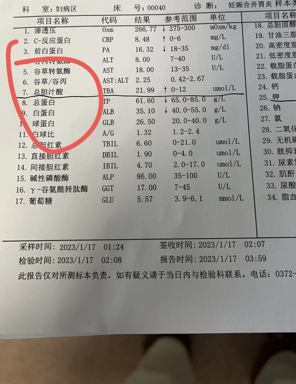 孕妇总胆汁酸偏高怎么回事 昨晚点了个外卖,吃完半夜胃疼的只打滚那种