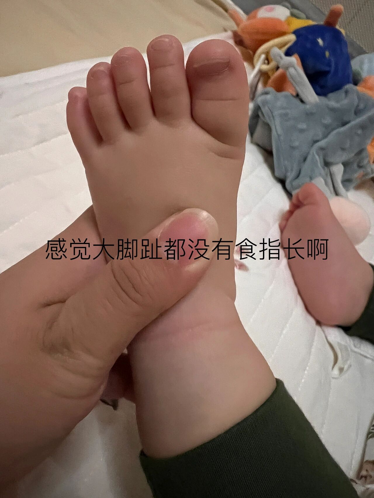 求助求助 求助万能的 请问婴儿脚趾这样正常吗?