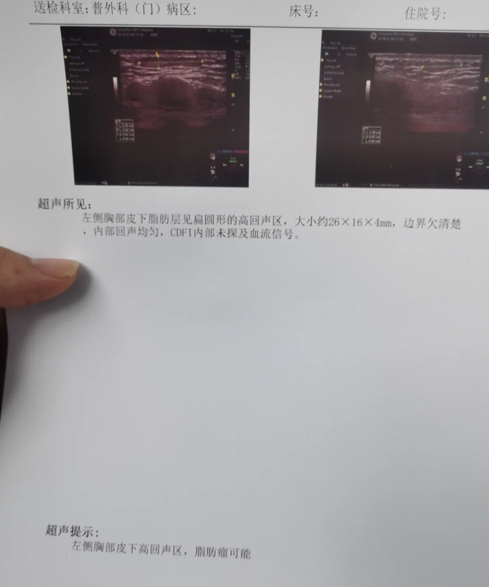 胸口长硬疙瘩并且按压疼痛,常见原因包括皮脂腺囊肿,脂肪瘤或神经