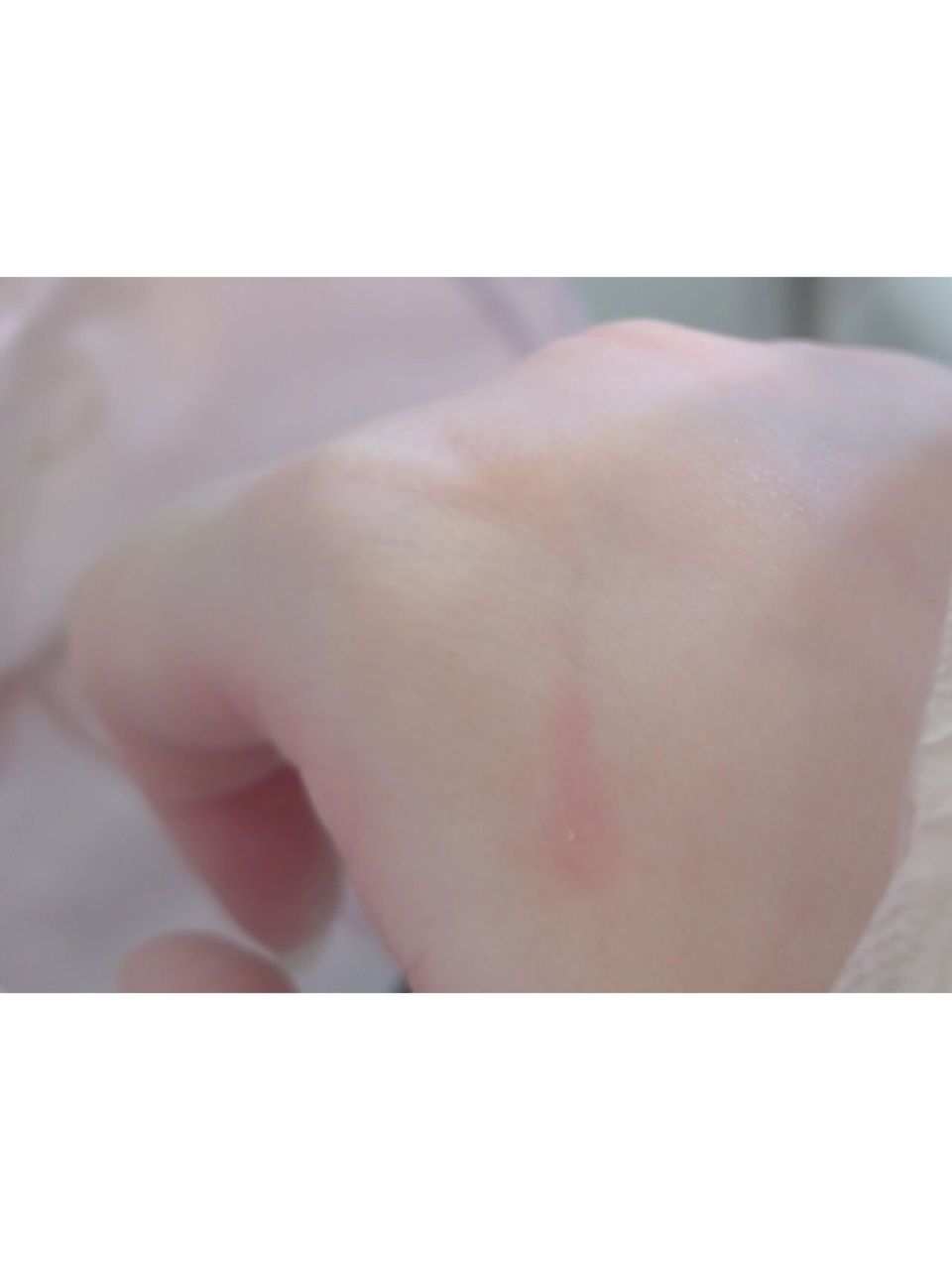 被狗爪子划破皮了没有流血要不要打疫苗 被宠物咖的柯基爪子划破皮了