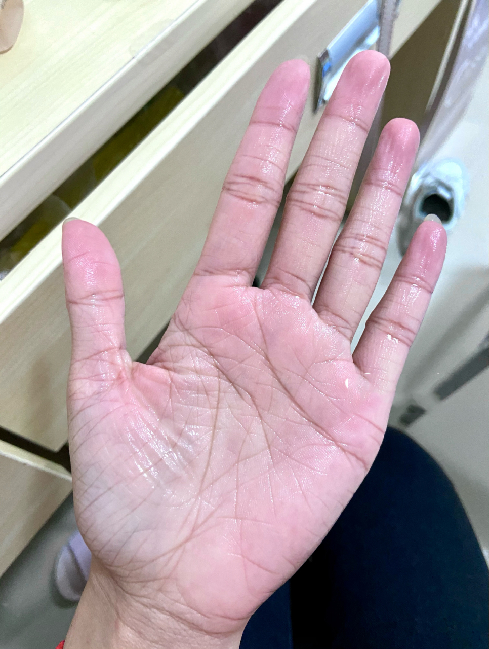 9215手掌粗糙怎么解决!