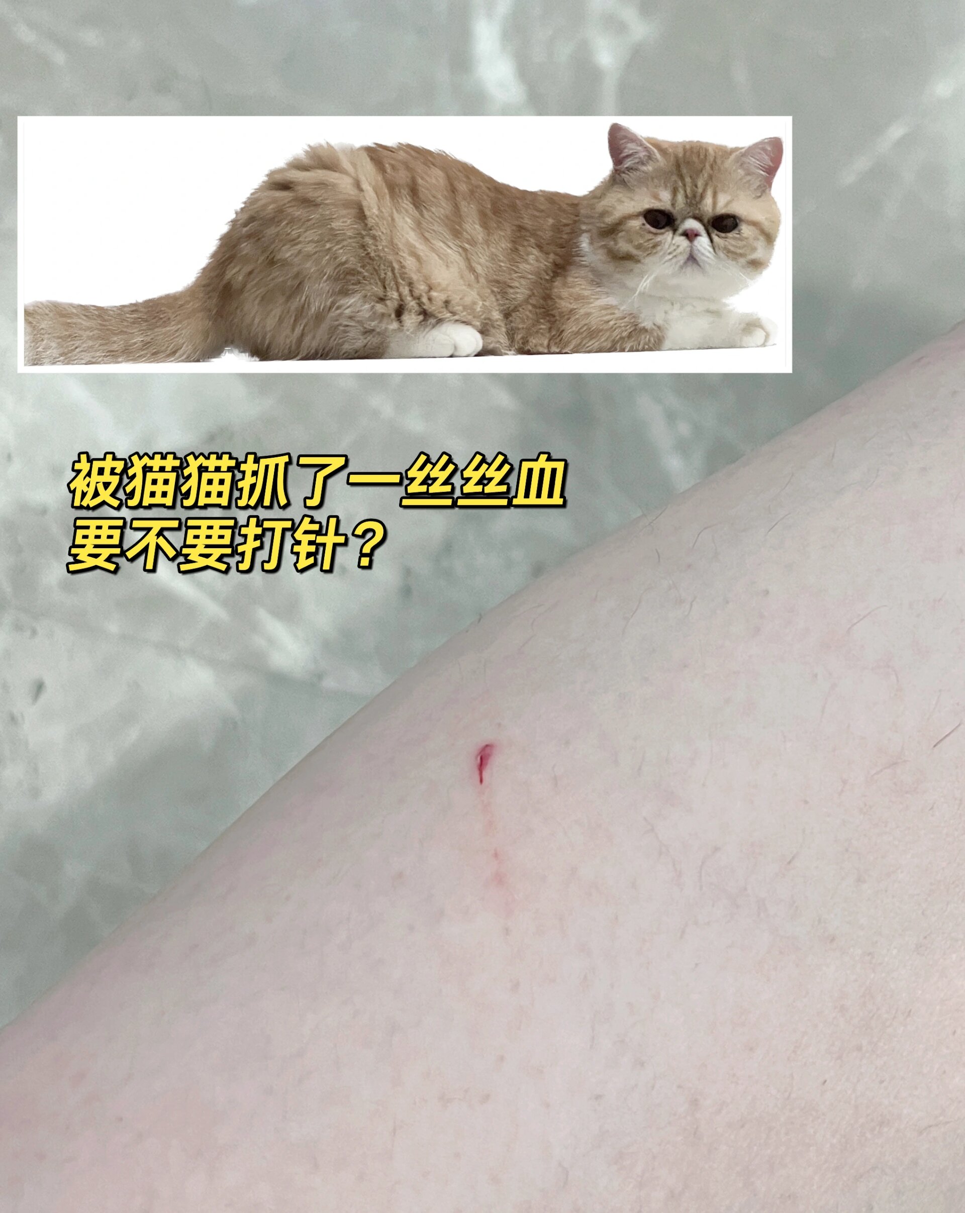 被猫抓伤出血要打针吗图片