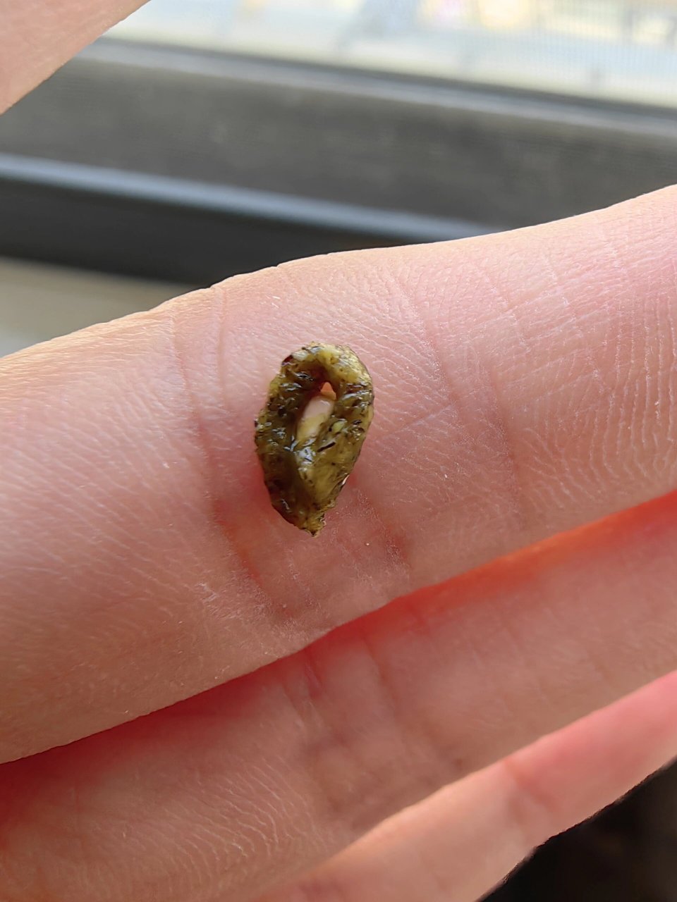 屎黏着,而且它拉出来的便便里面看起来总是有杂质,不知道是生什么病了