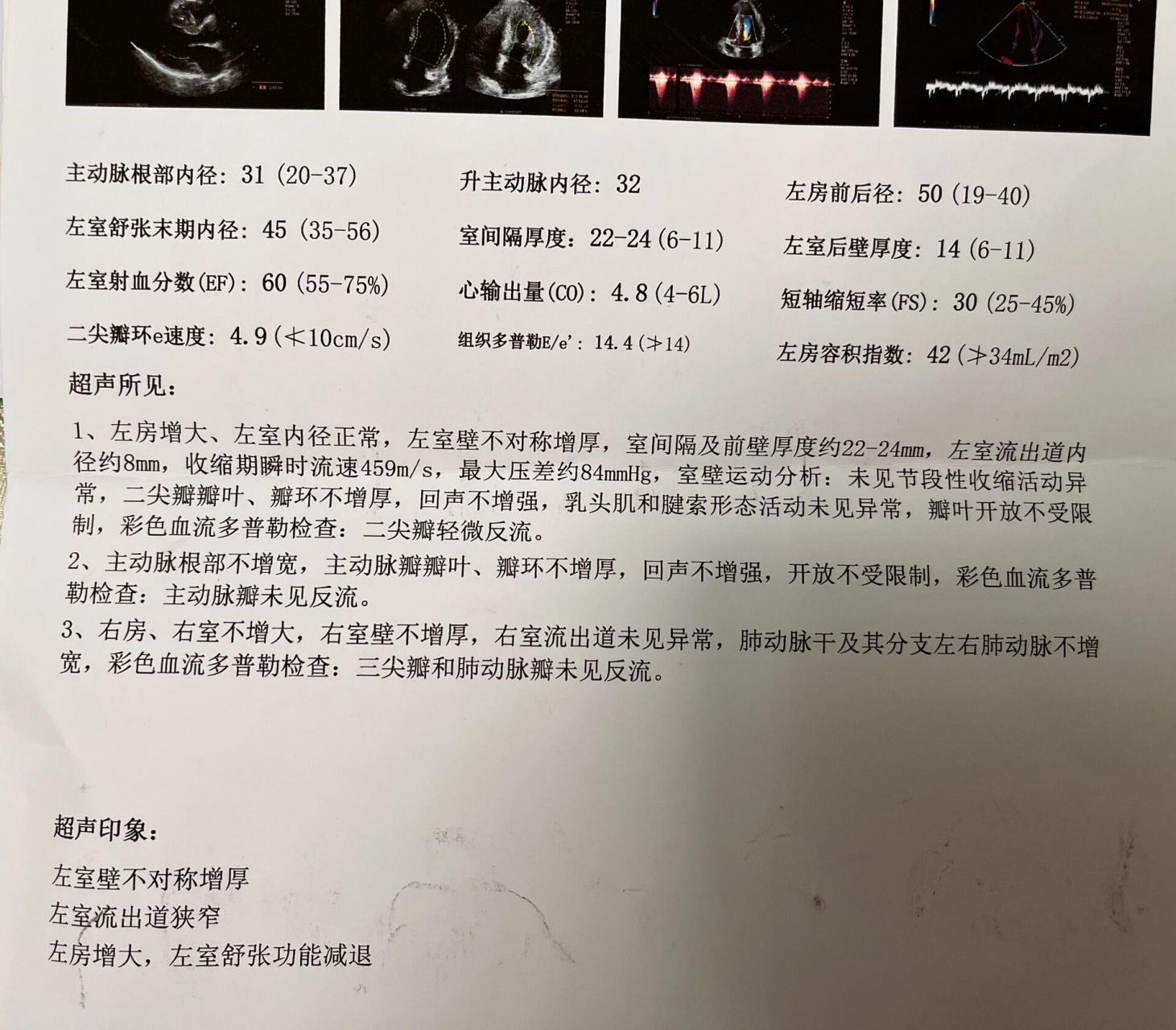 肥厚性梗阻性心肌病 家人复查心超,别的指标和三个月前差的不是很多