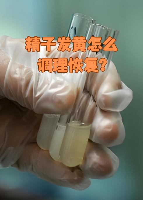 射出的精子为什么发黄的简单介绍