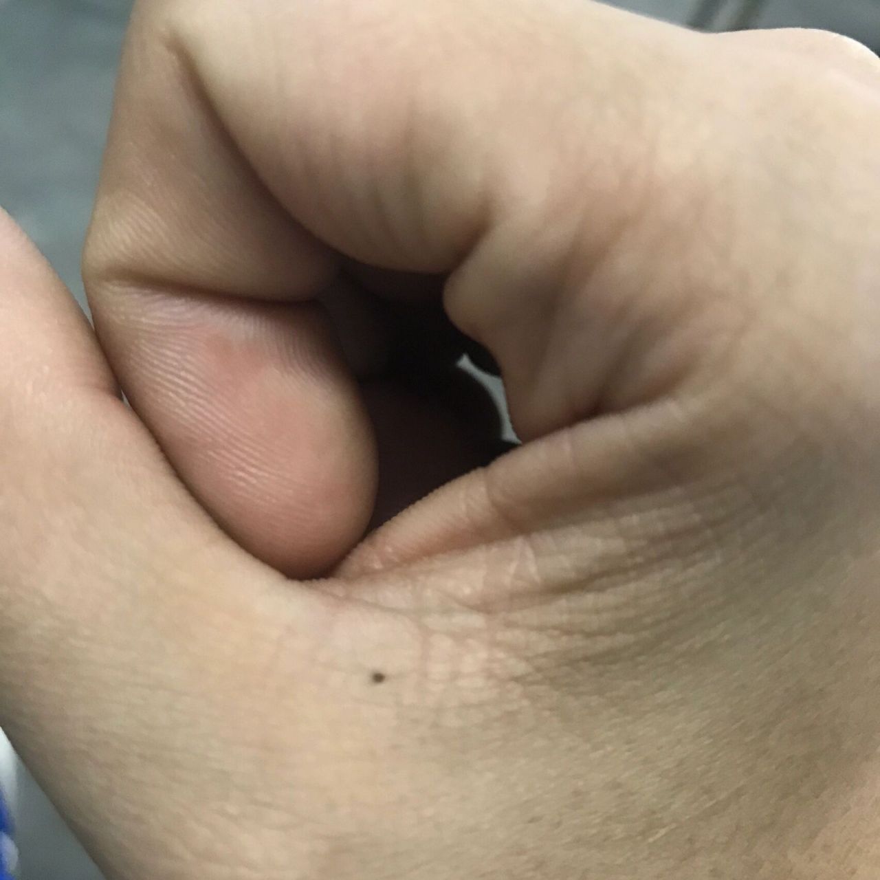 右手虎口有个痣