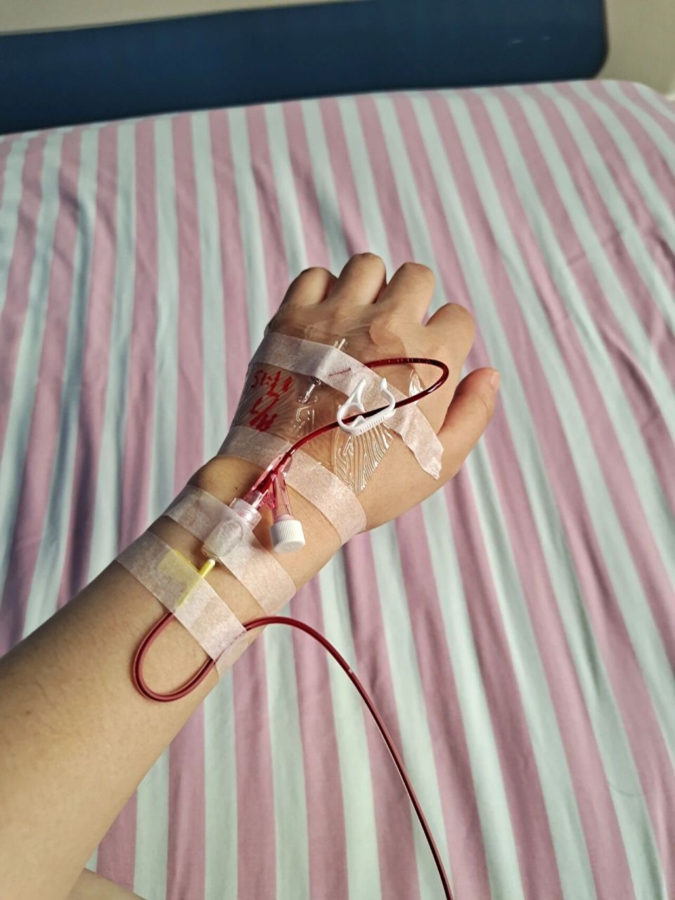 孕25 3中度贫血来医院输血 熬过了nt,四维,糖耐结果卡在了贫血