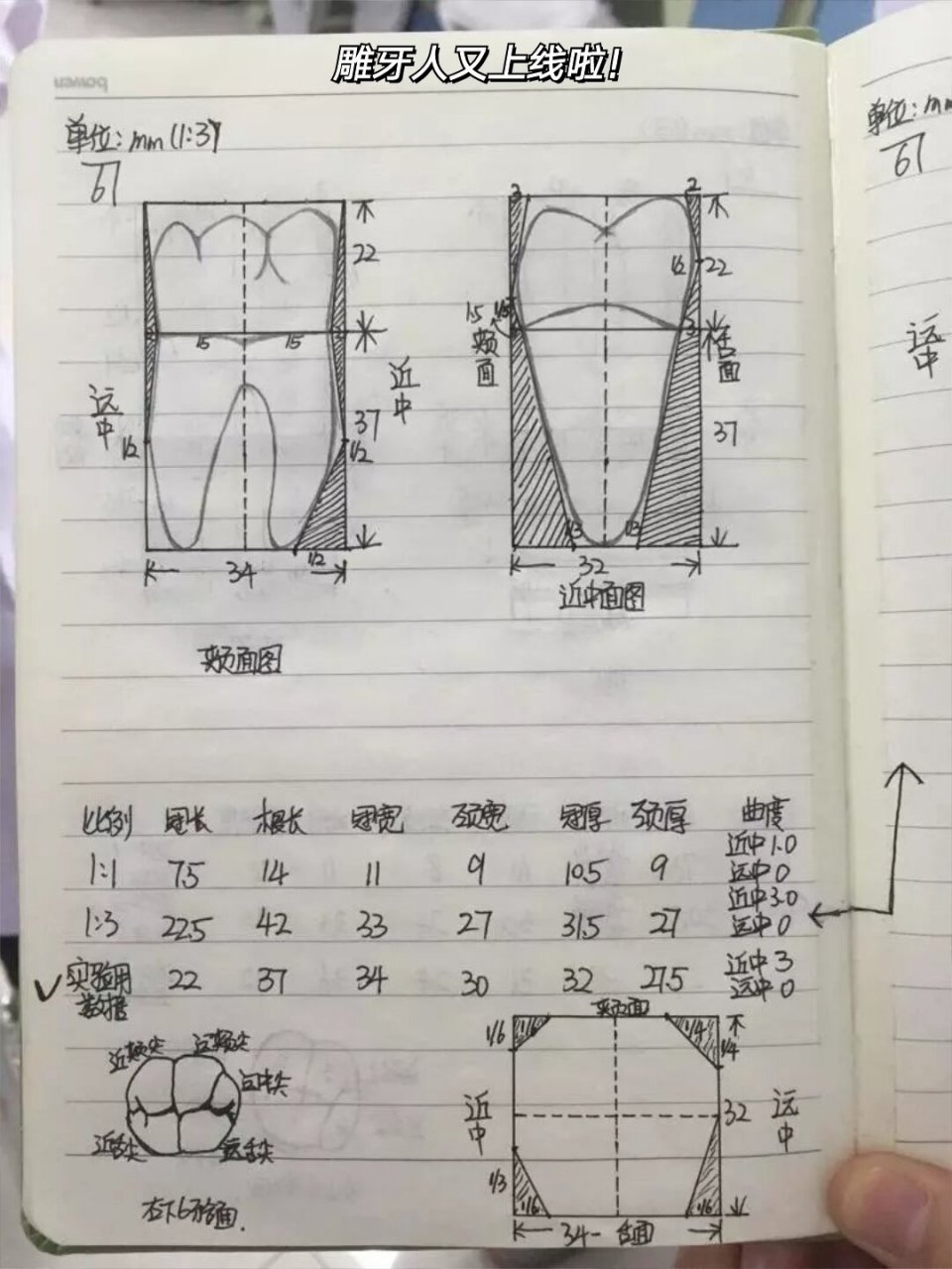 下颌6雕刻方法图片