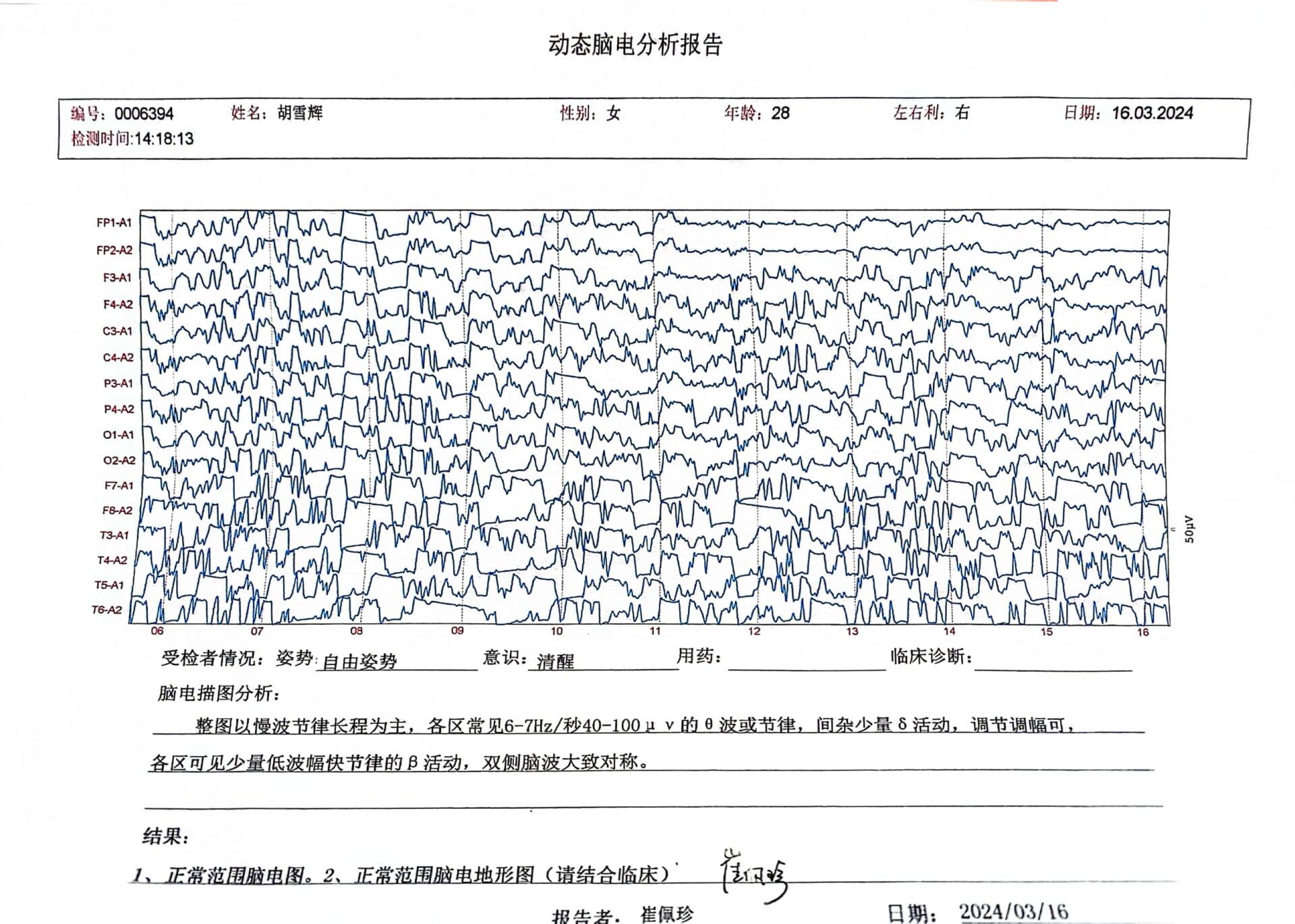 脑涨落图分析报告图片