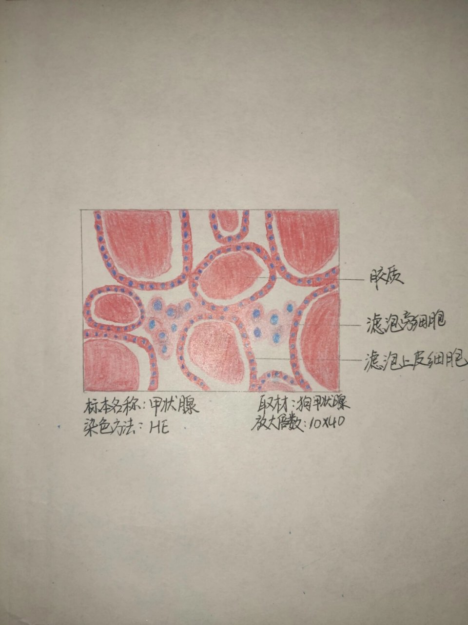 甲状腺切片手绘图图片