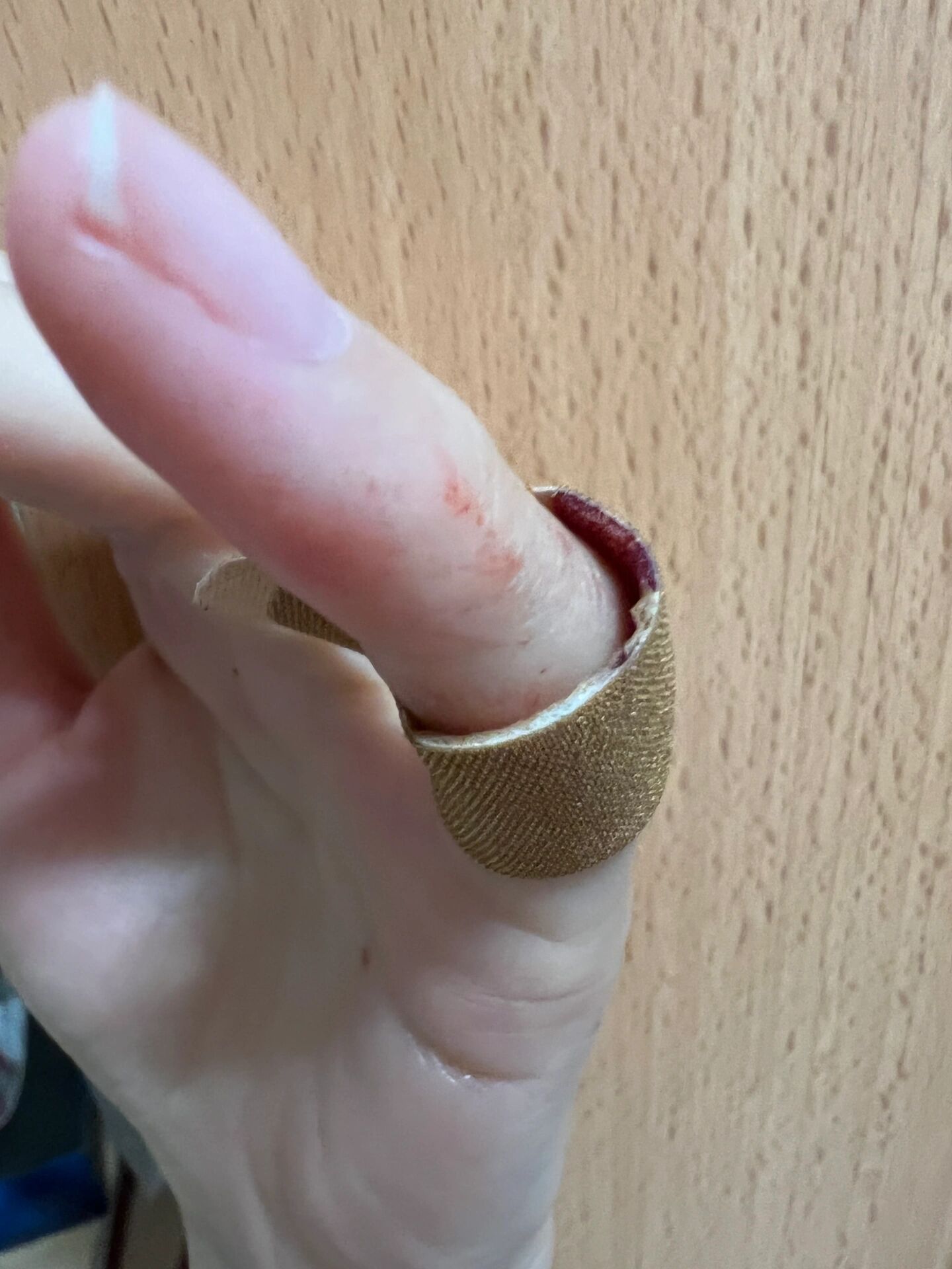 吃核桃用刀把自己的手划了一个很深的口子,刚划的时候还在想可真深