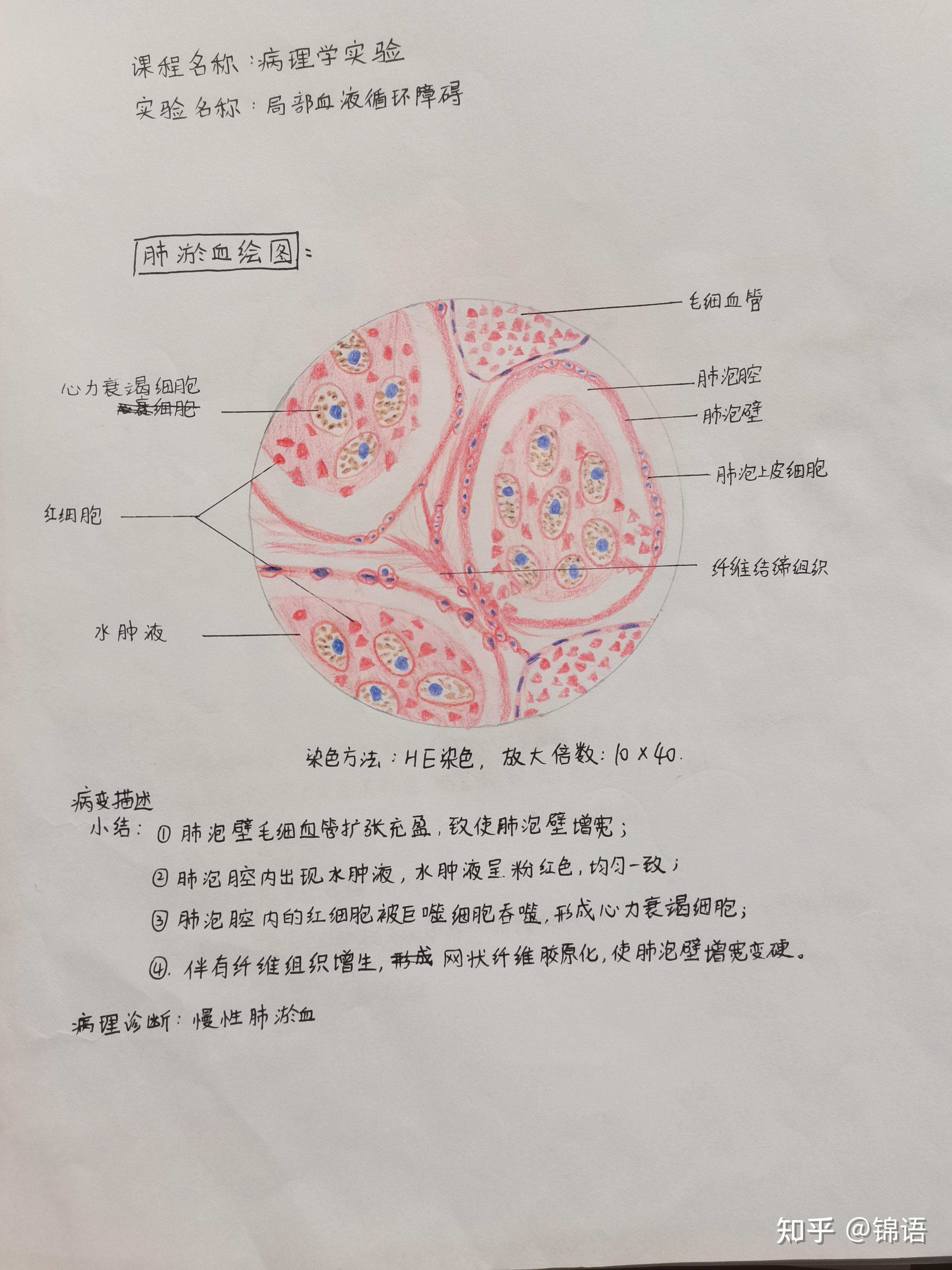 病理学实验报告一红蓝铅笔图肝脂肪变性慢性肺淤血肺结核肉芽肿