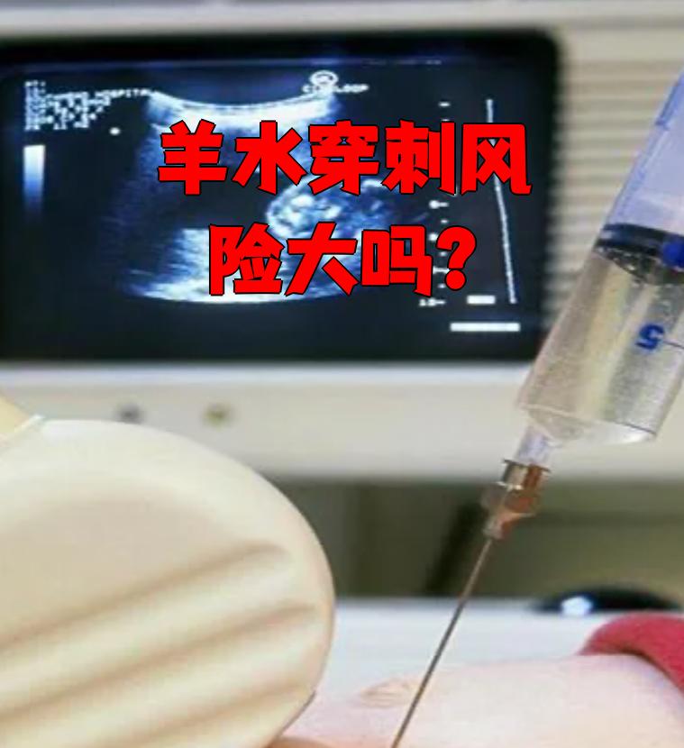 羊水穿刺确实有风险,但整体风险不大