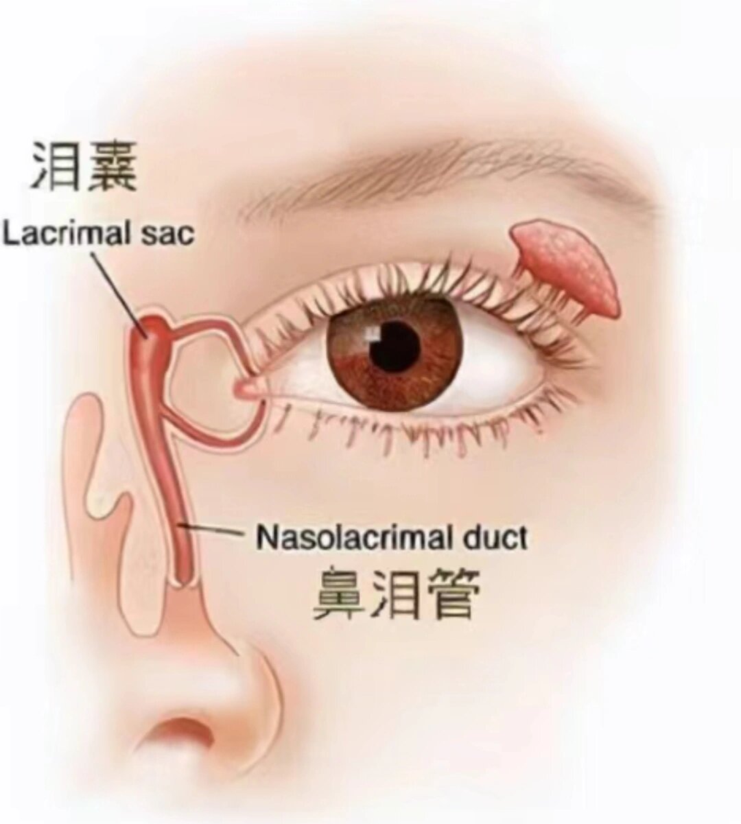 宝宝鼻泪管堵塞按摩手法