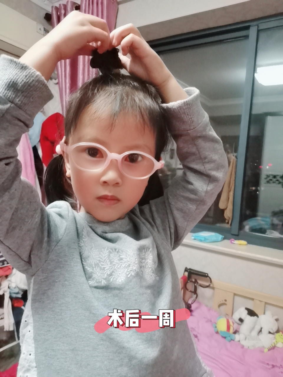 2岁半再去查,查出来间歇性内斜,而且是2只眼睛交替内斜视,医生说如果