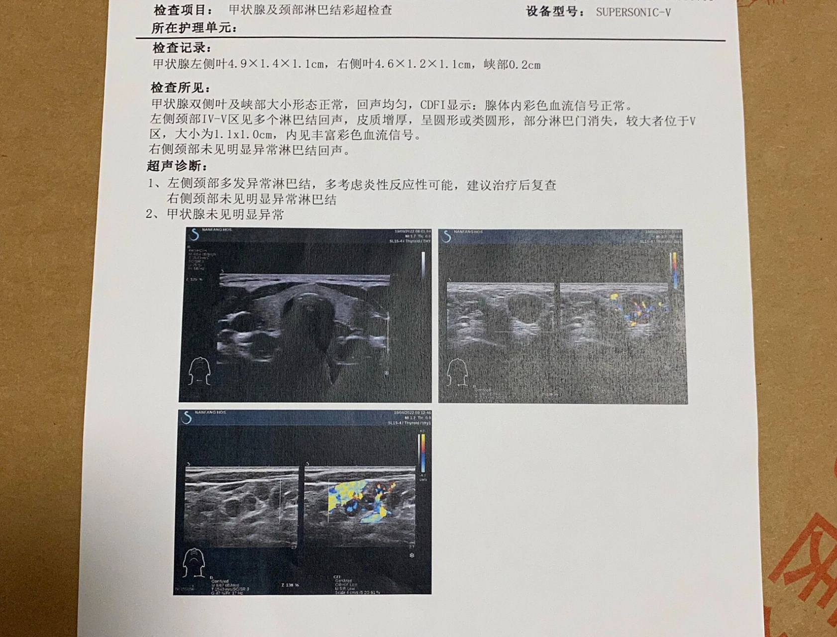 有懂淋巴结肿大的小伙伴吗 左锁骨窝,以及左侧脖子的淋巴都肿大了