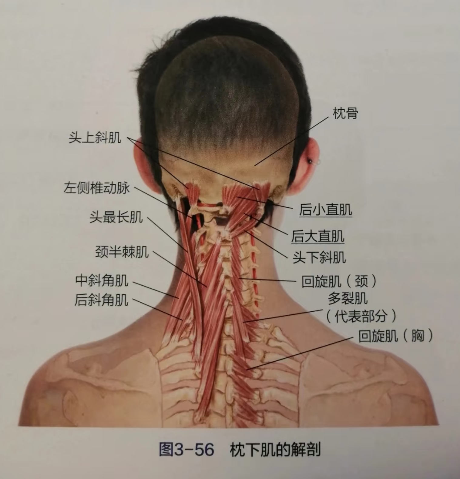 颈椎两侧的筋疼最常见的原因是颈椎病,肌肉劳损或颈部外伤