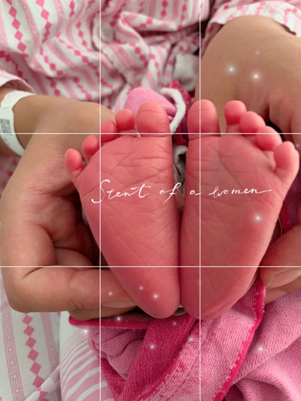 她决定生下那个唐氏综合征宝宝9299 想起一个陈年老故事.