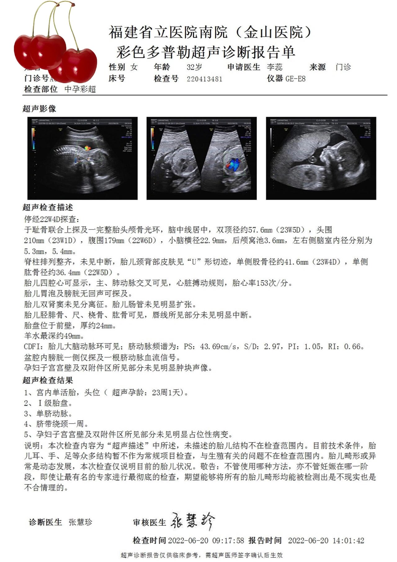 半半在大排畸时候查出单脐动脉,当时觉得天塌了,越查资料越害怕.