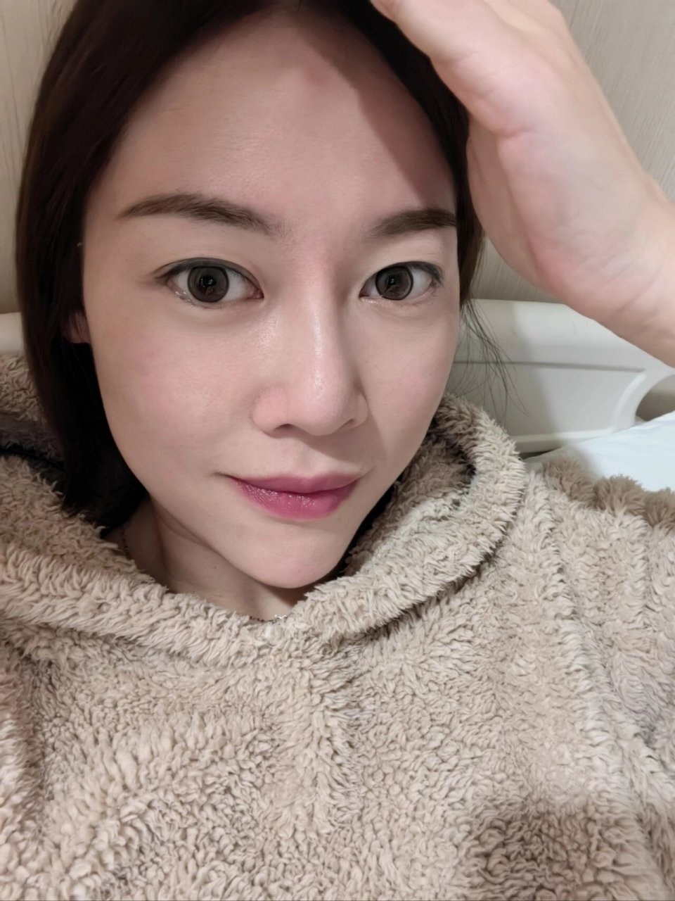 额骨骨瘤手术恢复中 希望不要复发了