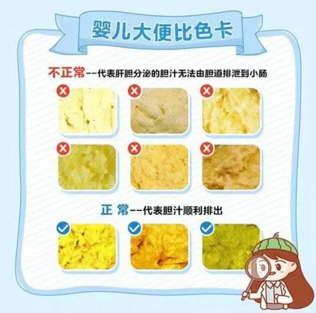 宝宝便便小知识,一起来学习吧 166蛋花汤样便——提示肠道感染, 2