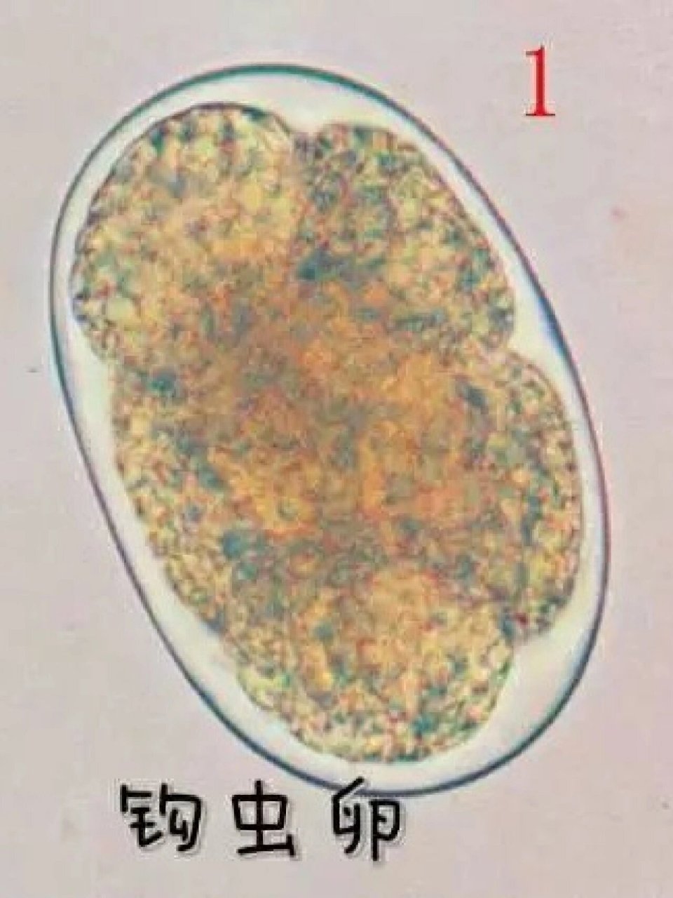 人体寄生虫卵图片