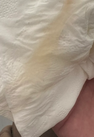 女生私处出现白色黏液,大部分情况是正常的 状 