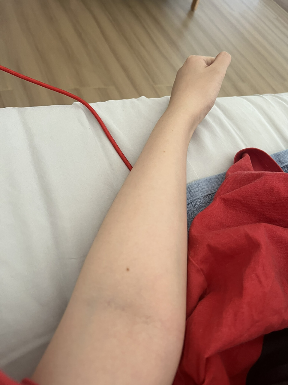 活了30年才知道这叫肘外翻 我小时候一直觉得我的胳膊很奇怪 跟别人长