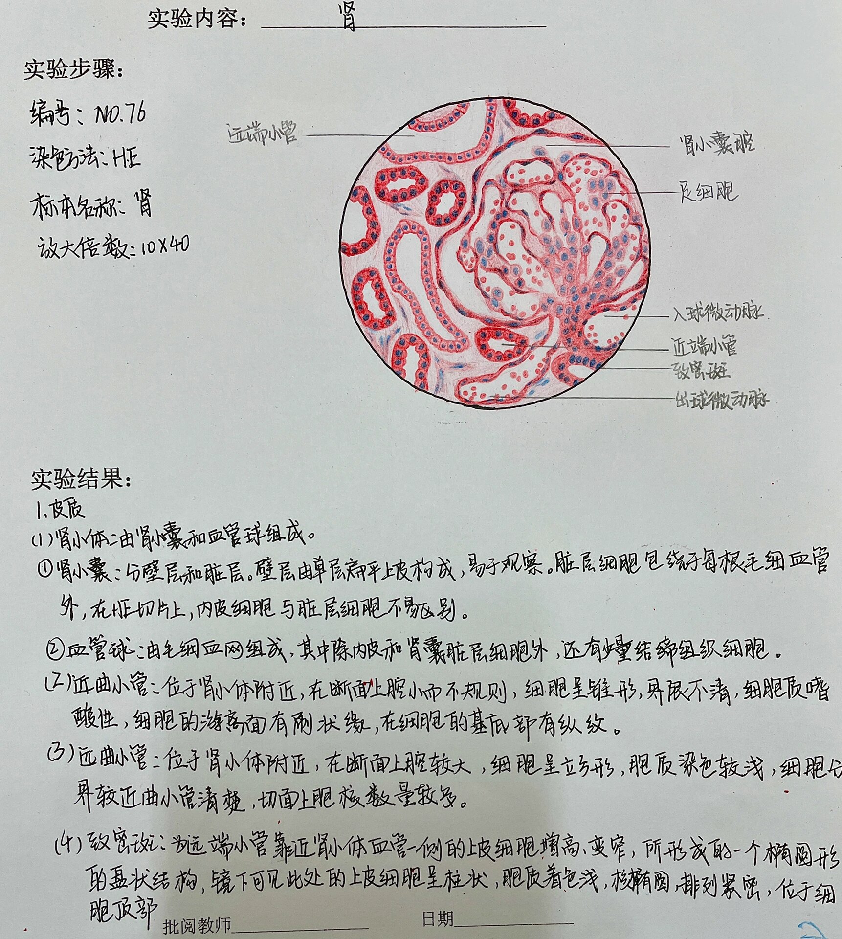 肠伤寒红蓝铅笔图图片