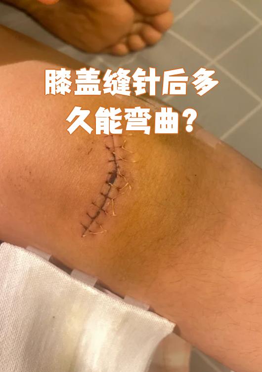 后多久能弯曲要看具体情况,主要和缝针的