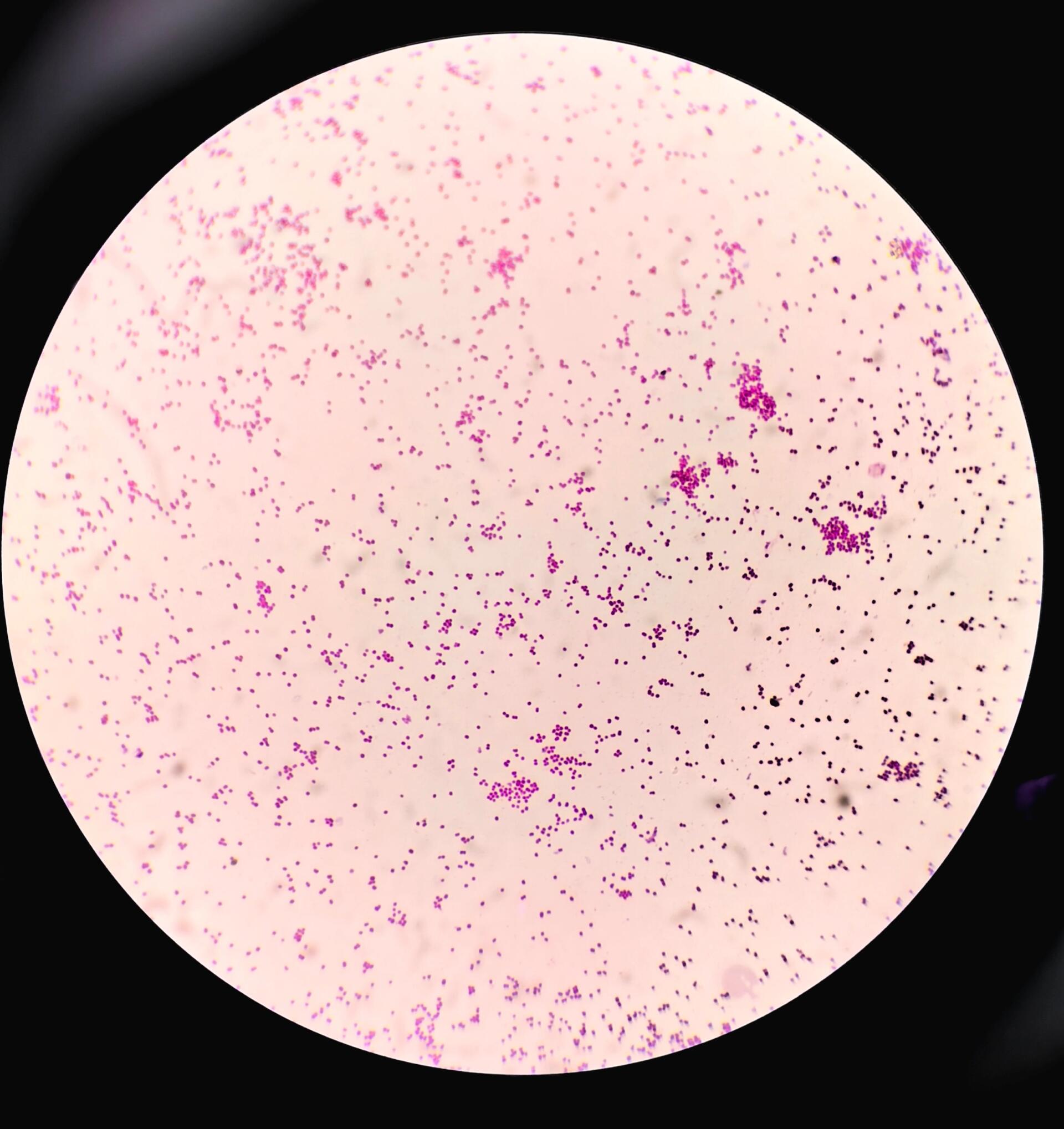 卡他莫拉 莫拉菌属(moraxella)与不动杆菌属同属莫拉菌科,共有15个种.