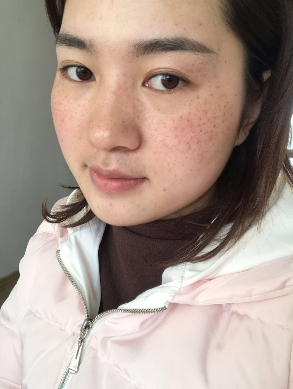 拯救一下我的麻子脸 从小就有,长大后越来越严重,怀过孕之后就更加