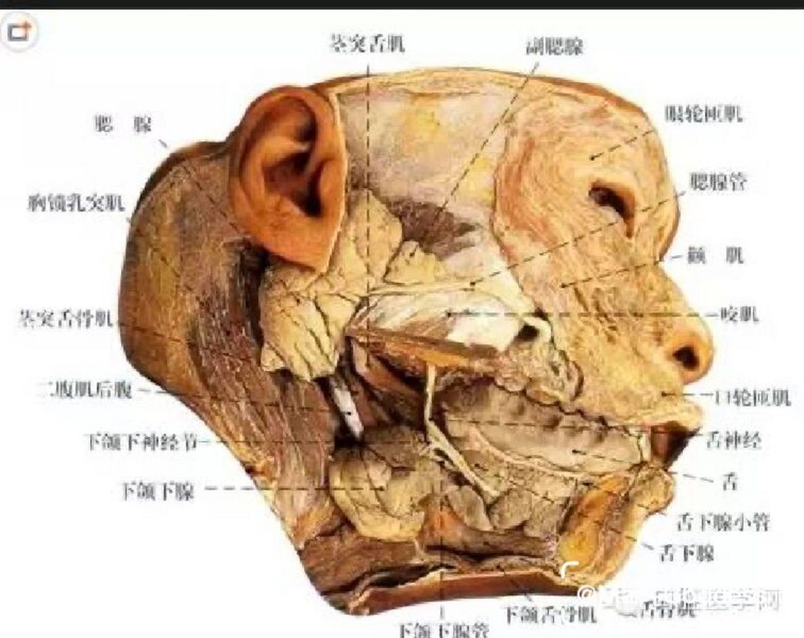 口腔腺解剖示意图 口腔腺(salivary dand)是开口于口腔的各种腺体的总