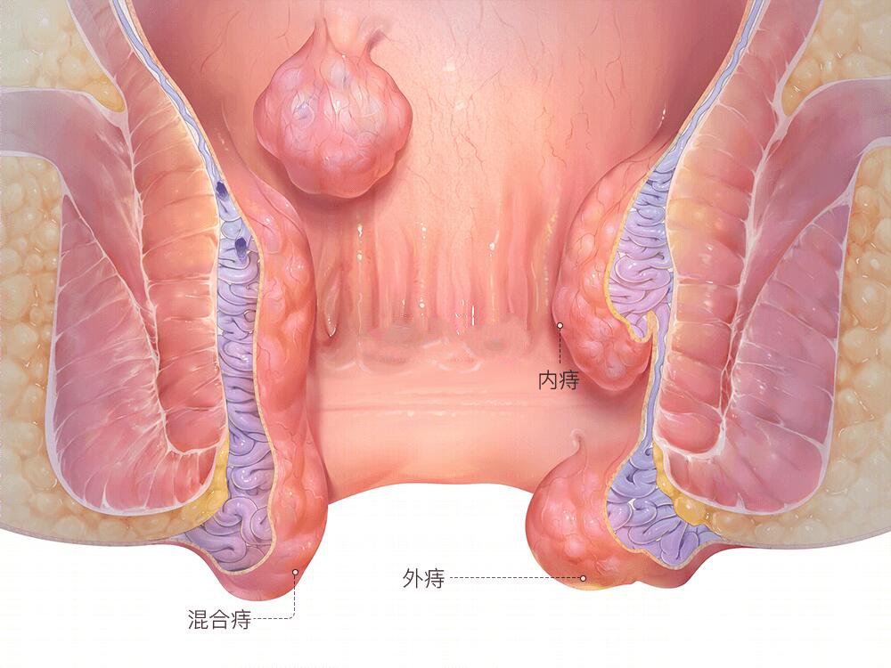 肛门直肠角图片