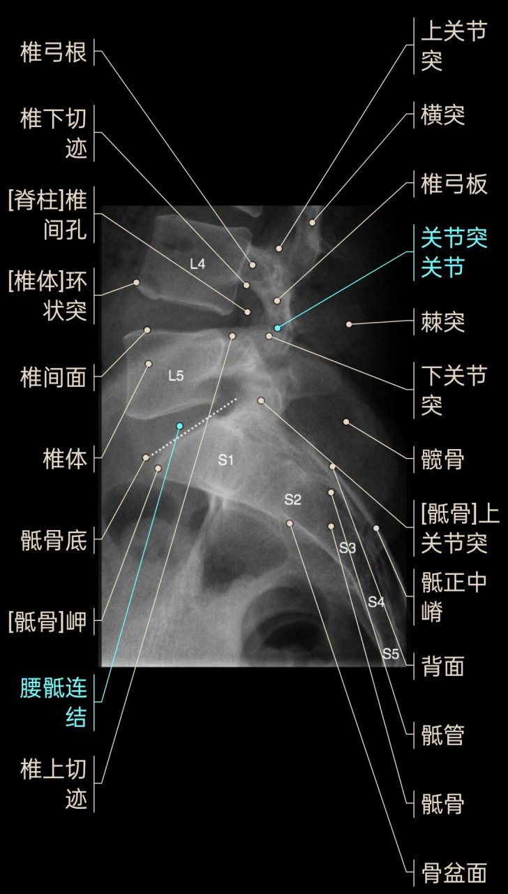 腰椎斜位x线摆位方法图片