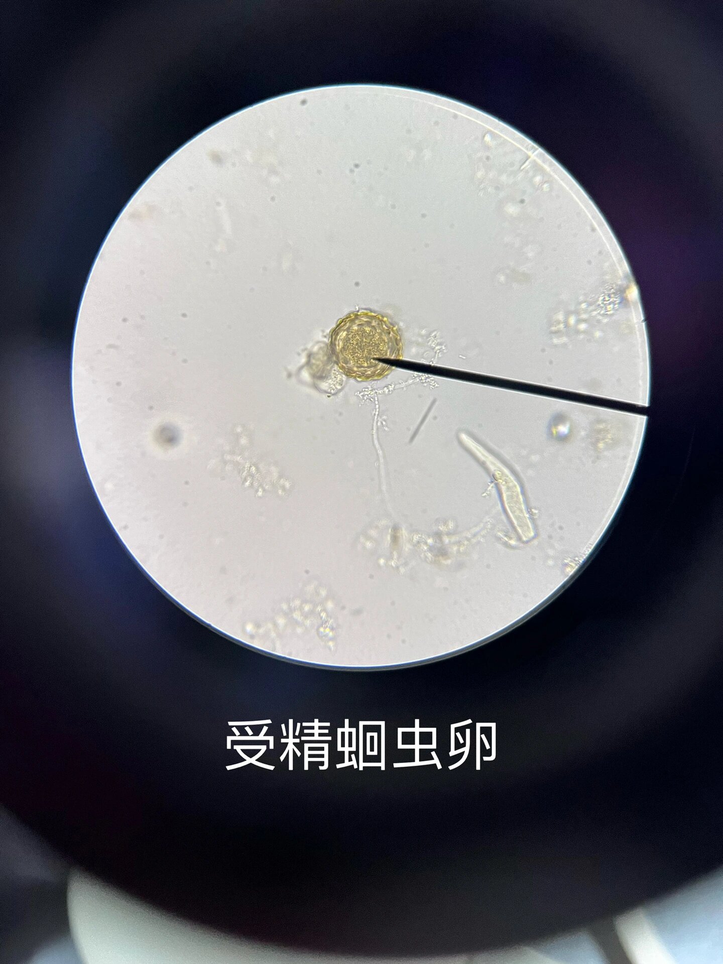 高倍镜下虫卵绘图(附照片 线虫纲:受精蛔虫卵,未受精蛔虫卵,蛲虫卵