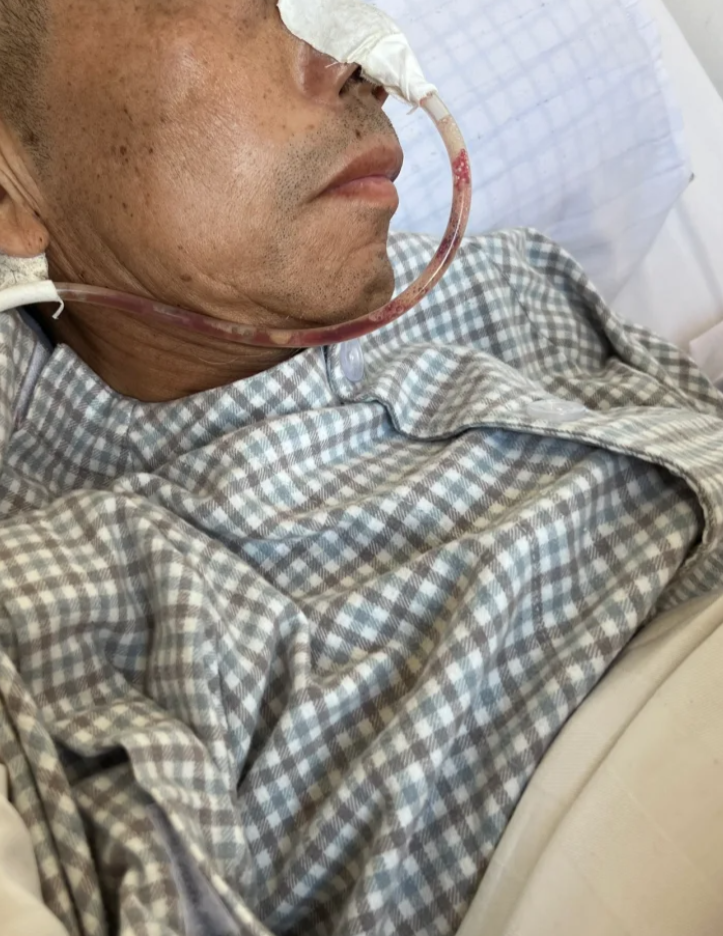病人自己把胃管拔了有危险吗