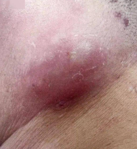 下面具体说明这些情况以及对应的处理方法