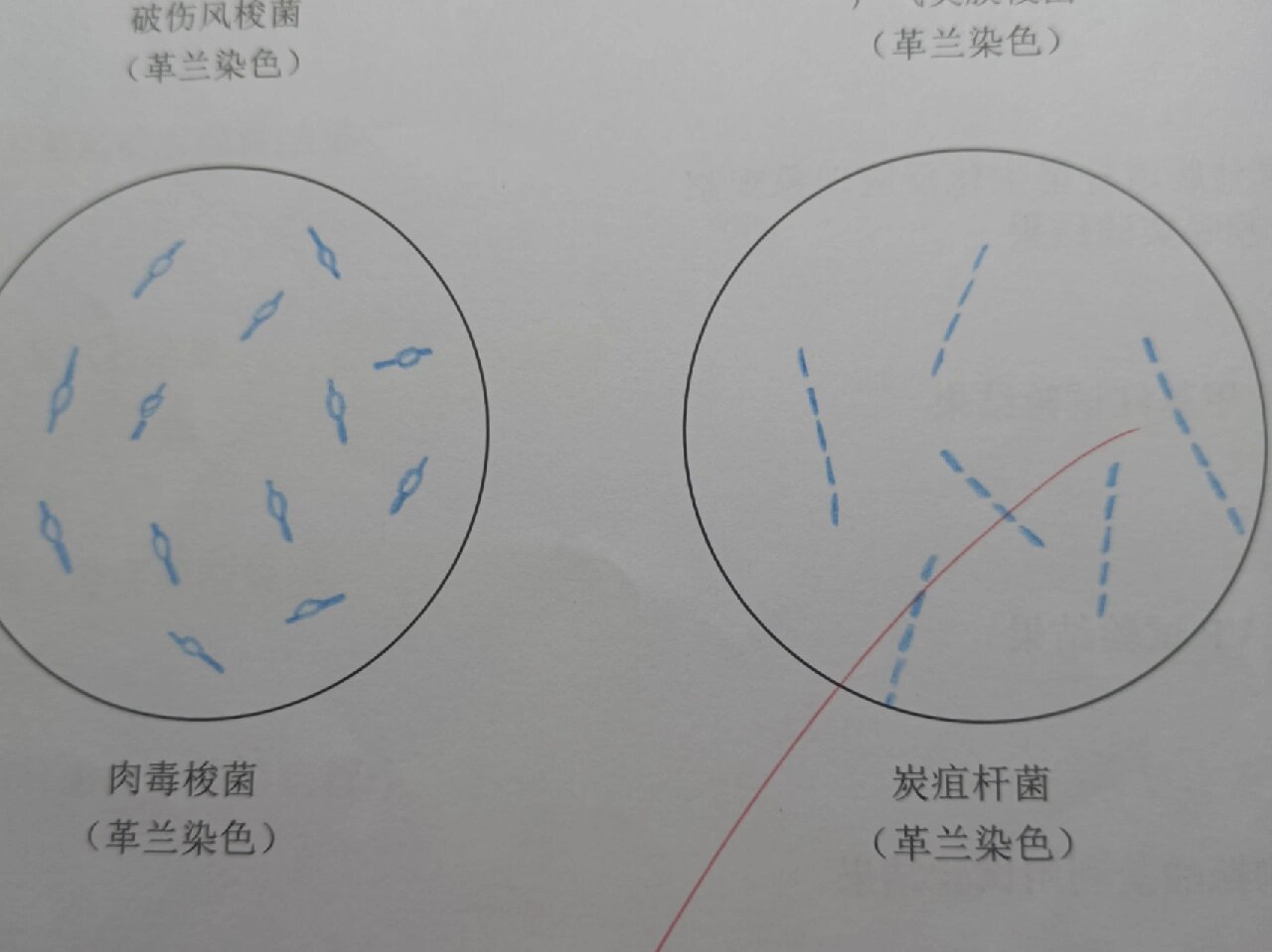 破伤风杆菌红蓝铅笔图片