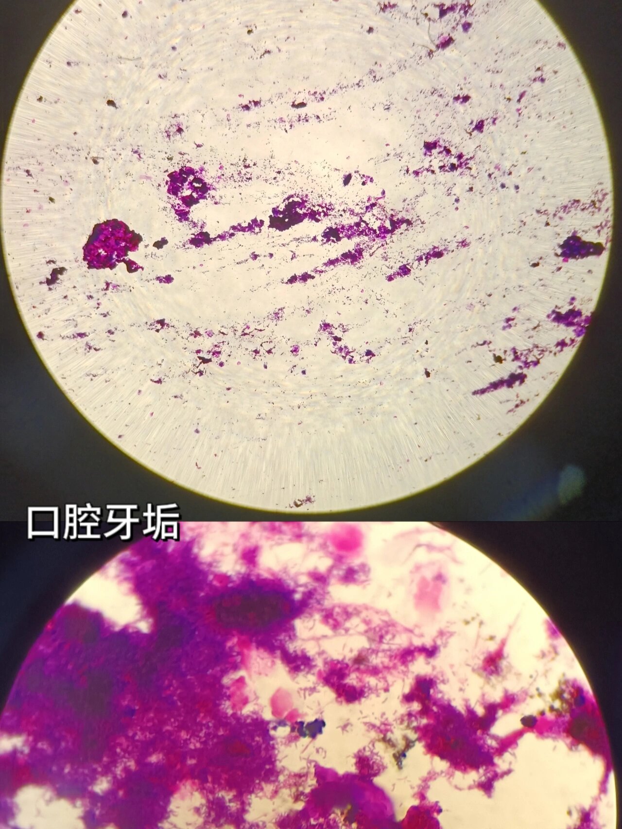 医学微生物学实验报告|革兰染色 实验一:细菌的形态学检查 革兰染色
