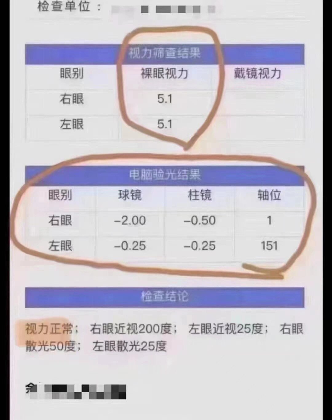 裸眼视力与屈光度数并不是一对一的关系 温61提馨69示6760