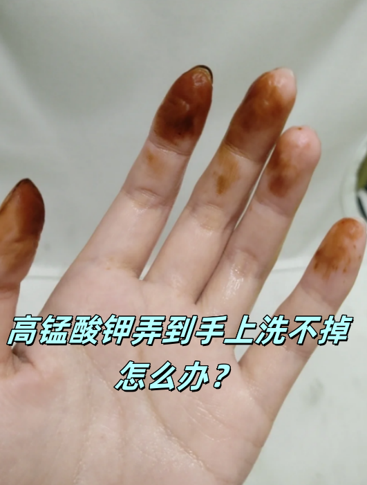 药店为什么不让卖高锰酸钾