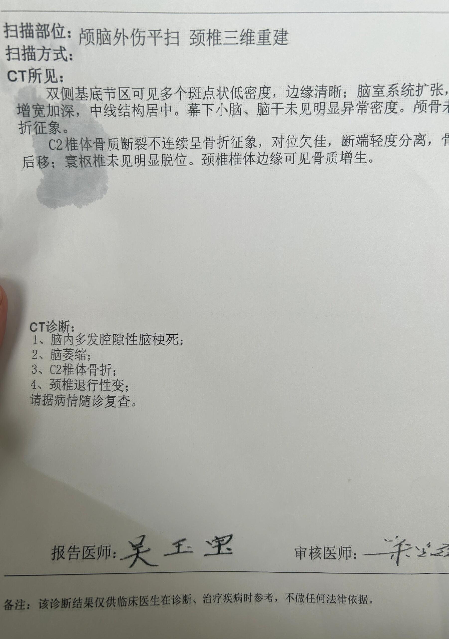 颈椎骨折暂时捡回一条命 昨天晚上爸爸骑电动车摔倒了,颈椎c2骨折