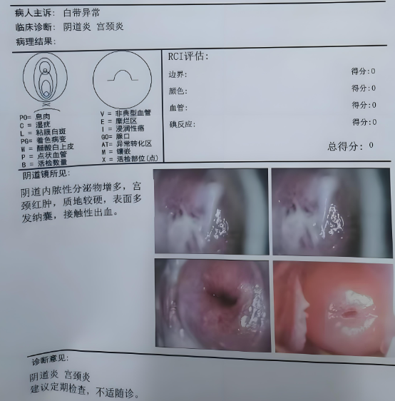 怎么回事  阴道出现白色果冻样分泌物可能是正常现象,也可能和宫颈炎
